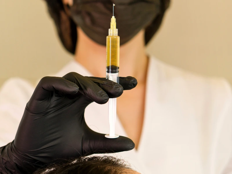hair restoration services