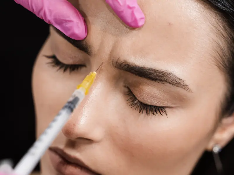 what is ellanse filler